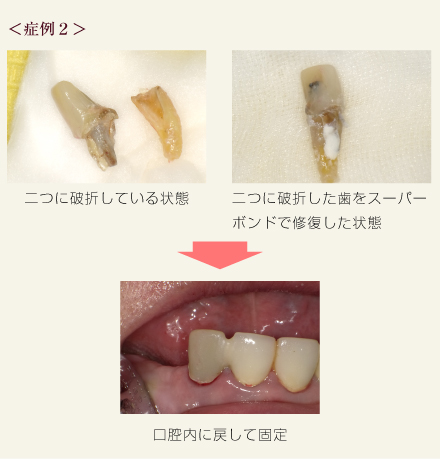 症例2