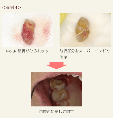 症例4
